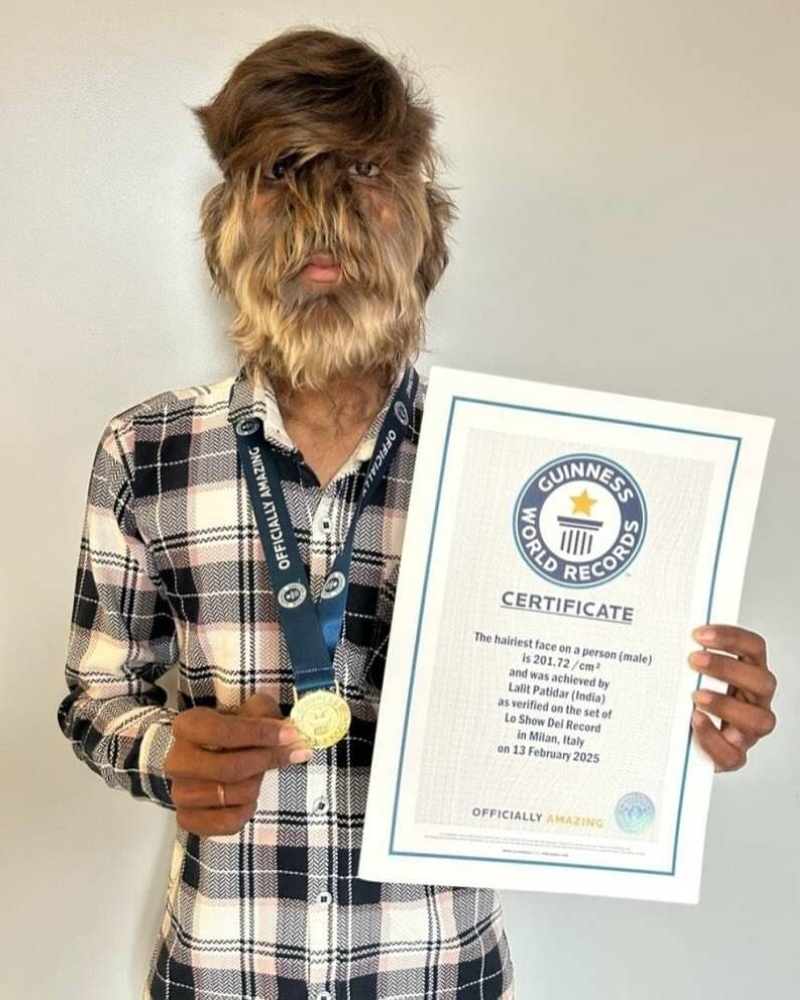 «الرجل الذئب» في «غينيس» ! - أخبار السعودية 5 «الرجل الذئب» في «غينيس» ! - أخبار السعودية