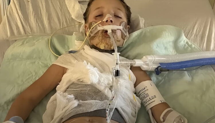 تحدي "تيك توك" يتسبب بإصابة طفلة بحروق خطيرة ودخولها غيبوبة | منوعات