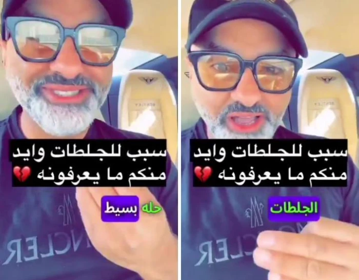 شاهد .. مختص يكشف أسباب الإصابة بالجلطة.. وما يحدث للجسم في حال تناول كمية قليلة من المياه 2 شاهد .. مختص يكشف أسباب الإصابة بالجلطة.. وما يحدث للجسم في حال تناول كمية قليلة من المياه