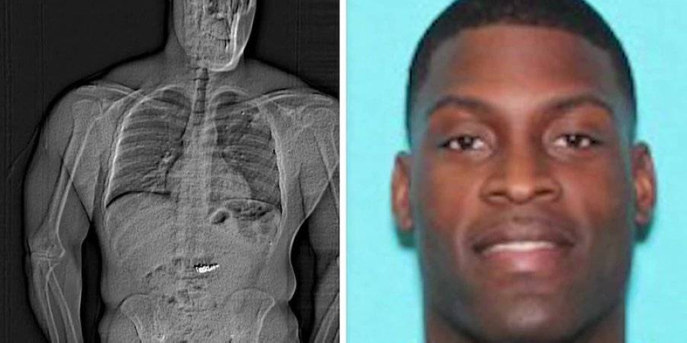 لص يبتلع أقراطاً ماسية بـ769,500 دولار.. والشرطة تنتظر 12 يومًا لاستعادتها! - أخبار السعودية 2 لص يبتلع أقراطاً ماسية بـ769,500 دولار.. والشرطة تنتظر 12 يومًا لاستعادتها! - أخبار السعودية